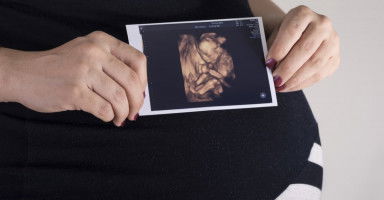 السونار رباعي الأبعاد لتصوير الجنين وأضراره المحتملة
