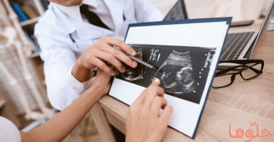 كيف يتم قياس وزن الجنين بالسونار؟