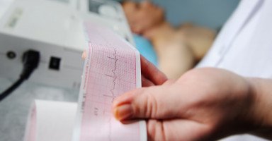 ما هو تخطيط القلب الكهربائي ولماذا يتم إجراء تخطيط القلب؟
