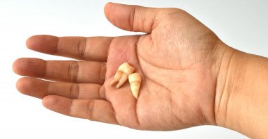 تفسير حلم سقوط الأسنان في اليد بالتفصيل