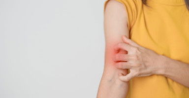 أعراض حساسية الأدوية وما تفعل إذا تحسست من دواء