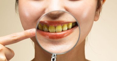تفسير الأسنان الصفراء في المنام وحلم اصفرار الأسنان