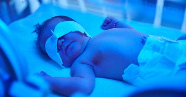 علاج الصفار عند الأطفال حديثي الولادة