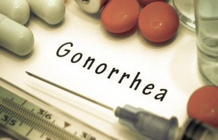 أعراض وعلاج السيلان البني (Gonorrhea)