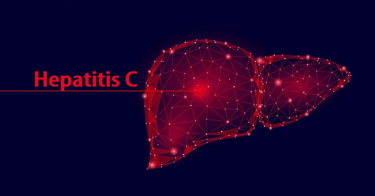 فيروس سي وأعراض التهاب الكبد من النمط C