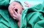 سبب بكاء الطفل عند الولادة وما معنى عدم بكائه