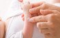 كيفية علاج الأكزيما عند الرضع وأسباب إكزيما الرضيع