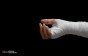 كيف أتصرف إن سألني زوجي عن الجروح في يدي اليسرى؟